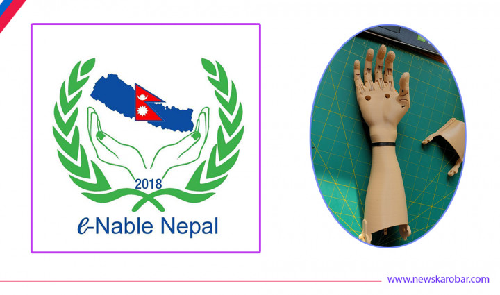 कृत्रिम हातमार्फत समाजमा खुशी छर्दै ‘ई-नेबल नेपाल’