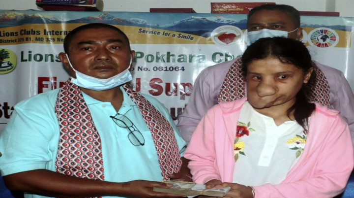 खत्रीको उपचारमा सहयोगी बन्यो लायन्स