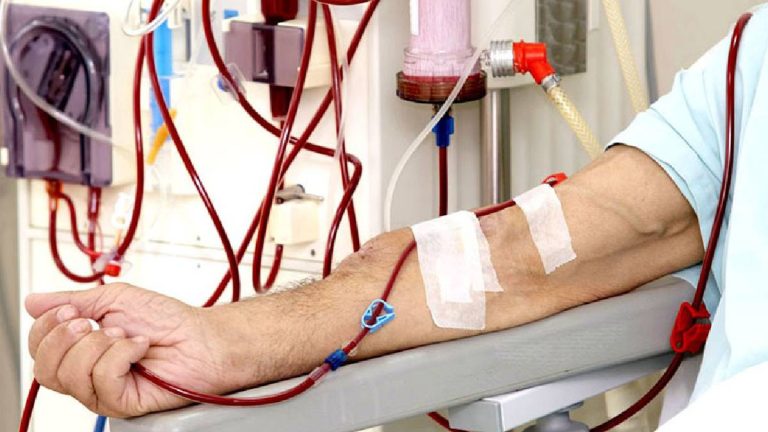 ‘डायलासिस’ उपकरण व्यवस्था मिलाउन माग