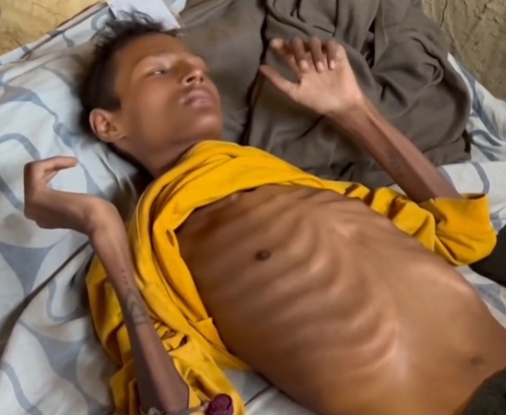 रोगले थलिएका १९ वर्षे विजय : उपचार नपाएर ओछ्यानमै सुक्दै छ शरीर