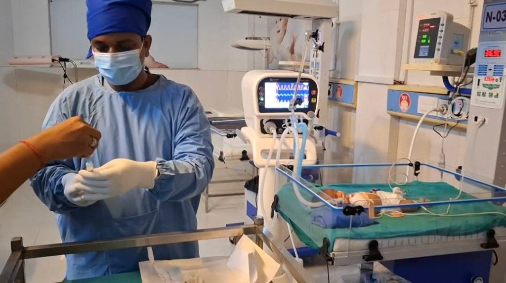 चन्द्रपुर अस्पतालमा पहिलो पटक नवजात शिशुको फोक्सोको जटिल उपचार सफल