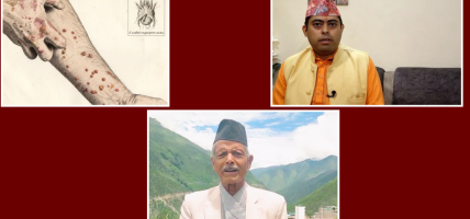 ‘लुतो जा…’, रोग भागोस्’ भन्दै यसरी मनाइन्छ सुदूरपश्चिममा लुतो पर्व