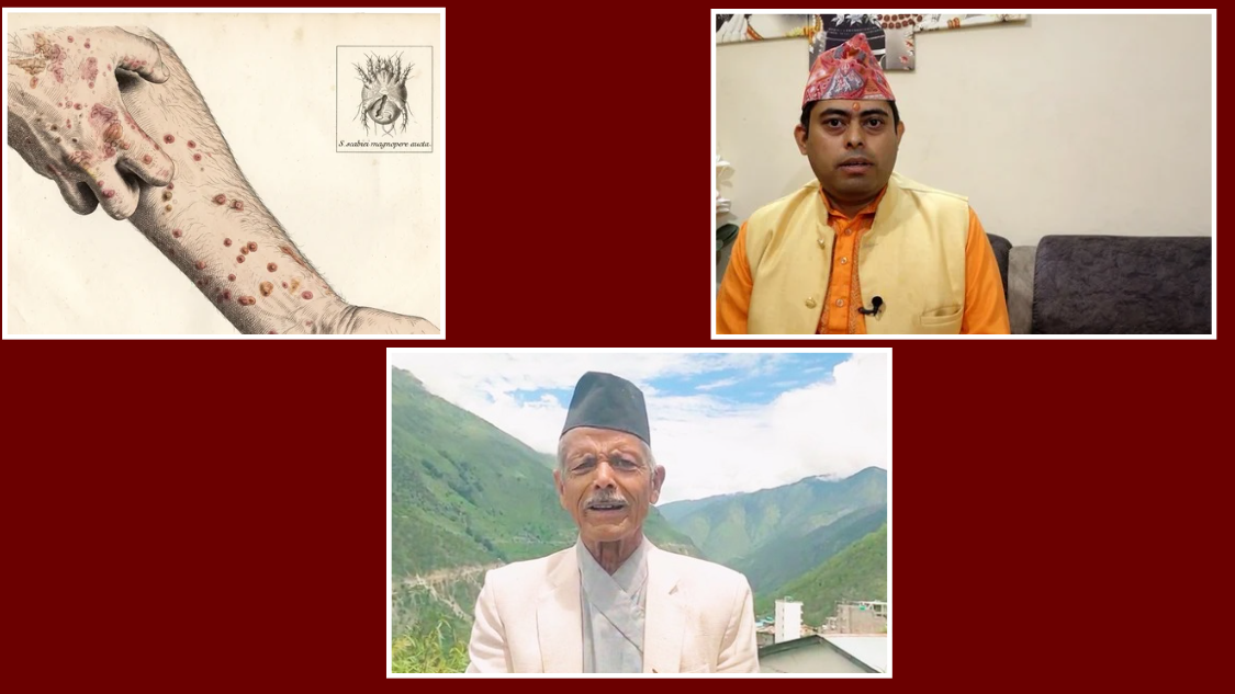 ‘लुतो जा…’, रोग भागोस्’ भन्दै यसरी मनाइन्छ सुदूरपश्चिममा लुतो पर्व