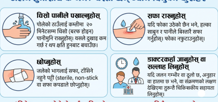 जलन हुनासाथ के गर्ने ? यस्ता छन् ध्यान दिनुपर्ने कुराहरू