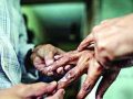 बाँकेमा १९३ कुष्ठरोगी बाँकेमा १९३ कुष्ठरोगी
