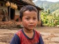 जुम्लामा पाइप बम विस्फोट, एक बालक गम्भीर घाइते, एकजनालाई सामान्य चोट